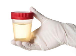 About Custom Drug Testing