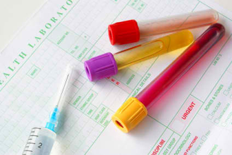 Custom Drug Testing Services